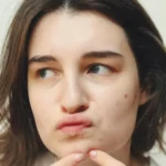 محصولات پیشنهادی برای پوست های جوش‌دار