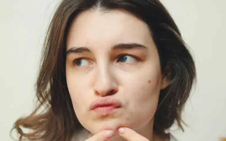 محصولات پیشنهادی برای پوست های جوش‌دار