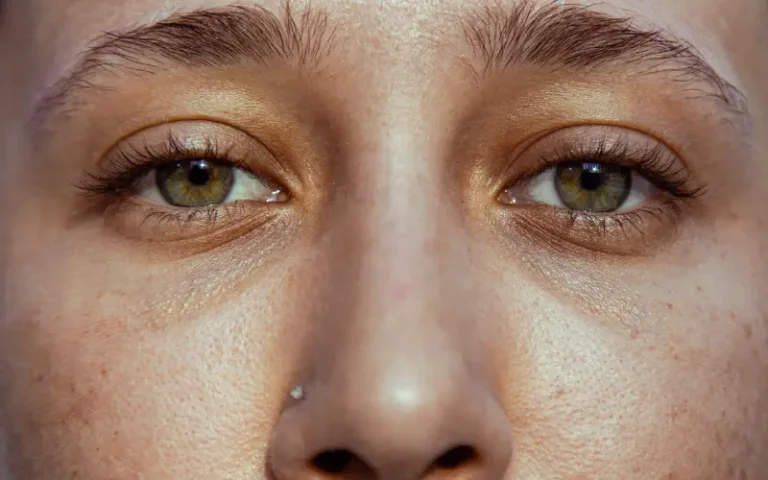 درمان منافذ باز پوست